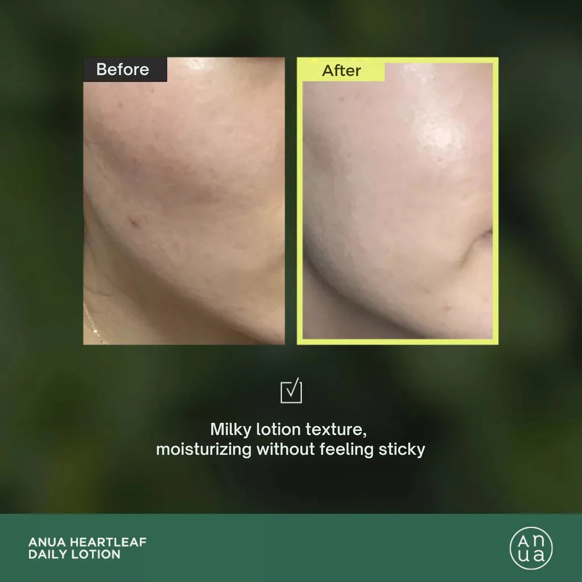 Anua Heartleaf 77 + Soothing Toner (500ml) and Anua Daily 70 + Lotion (200ml)