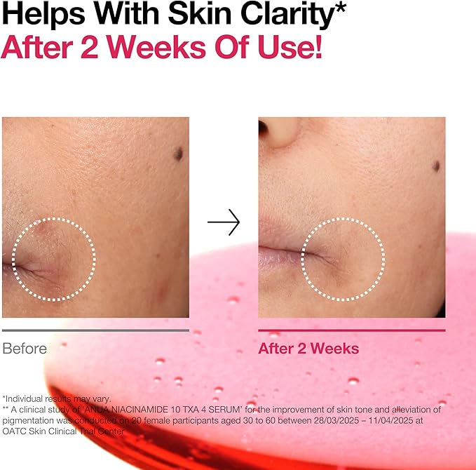ANUA 10% Niacinamide+ 4% Tranexamic Acid Serum (30ml /1.01 fl.oz.)